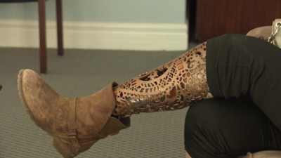 woman with prosthetic leg